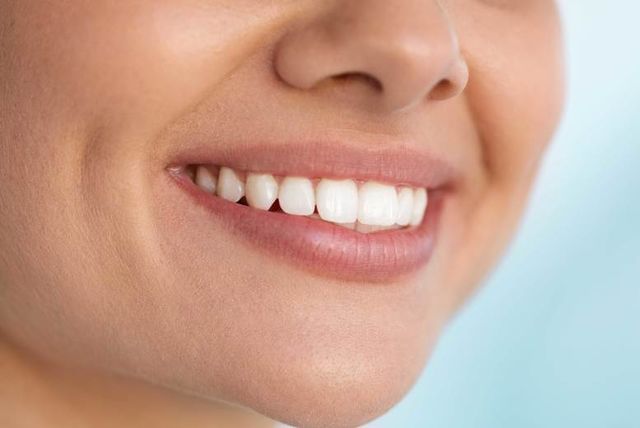 Zoom Teeth Whitening Voucher - Romford | Birmingham