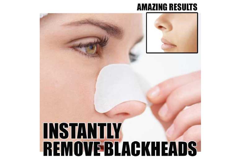 Deep Cleansing Blackhead Nose Strips from LivingSocial