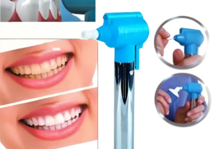 Luma Smile TeethWhitening Polish Machine at LivingSocial