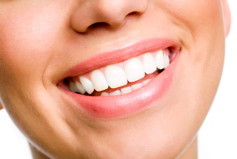 £999 instead of £2950 for a 10 teeth composite bonding at Icedent, London, or £1299 for 12, or £1699 for a 16 teeth option – save up to 66% £999 instead of £2950 for a 10 teeth composite bonding at Icedent, London, or £1299 for 12, or £1699 for a 16 teeth option – save up to 66%