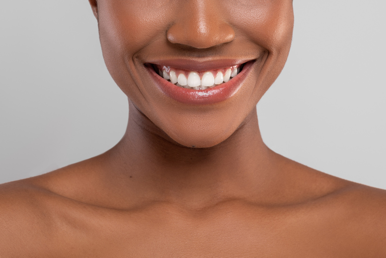 30-Minute Zoom Teeth Whitening from LivingSocial