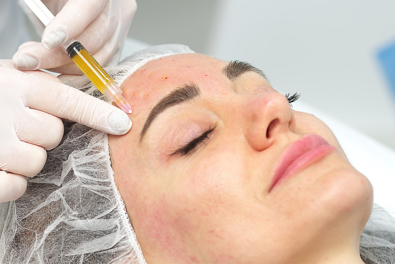 Klc Well-Being For All Unisex Prp Vampire Facial & Led Therapy - 1 Or 3 Smoothing Treatments At Wigston | Wowcher