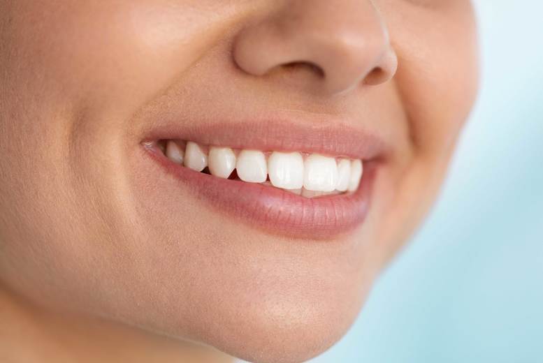 Deals teeth whitening london