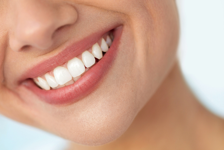 Pebble Brook Clinic Unisex Professional Teeth Whitening Session At - On-Site Treatment In Exeter | Wowcher