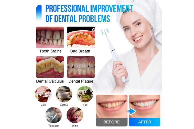 Ultimate Electric Sonic Teeth Cleaning Kit – Professional Oral Care at Home | Wowcher