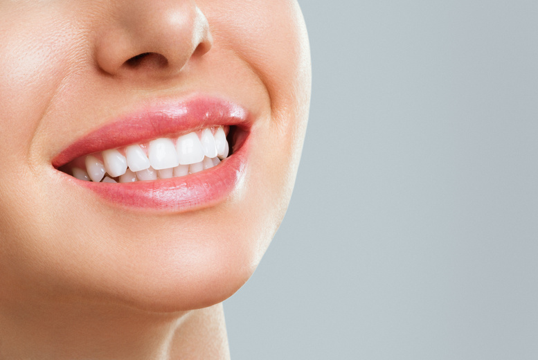 Laser Teeth Whitening – 1 or 3 Sessions at Mezzical Aesthetics, On-Site in Leeds | Wowcher Laser Teeth Whitening – 1 or 3 Sessions at Mezzical Aesthetics, On-Site in Leeds | Wowcher