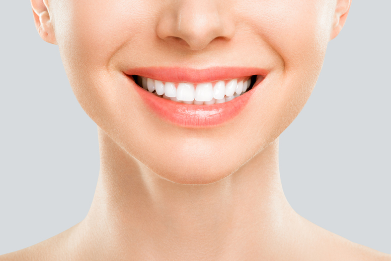 Naturawhite Teeth Whitening Treatment At Rouge Nails & Beauty, Birmingham | Wowcher