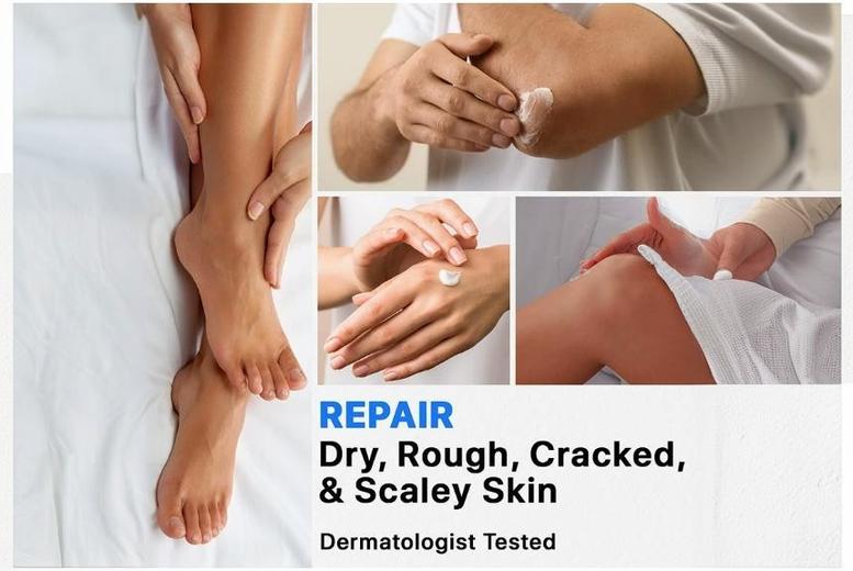 Urea Cream for Dry Skin – Advanced Hydration & Exfoliation | Wowcher