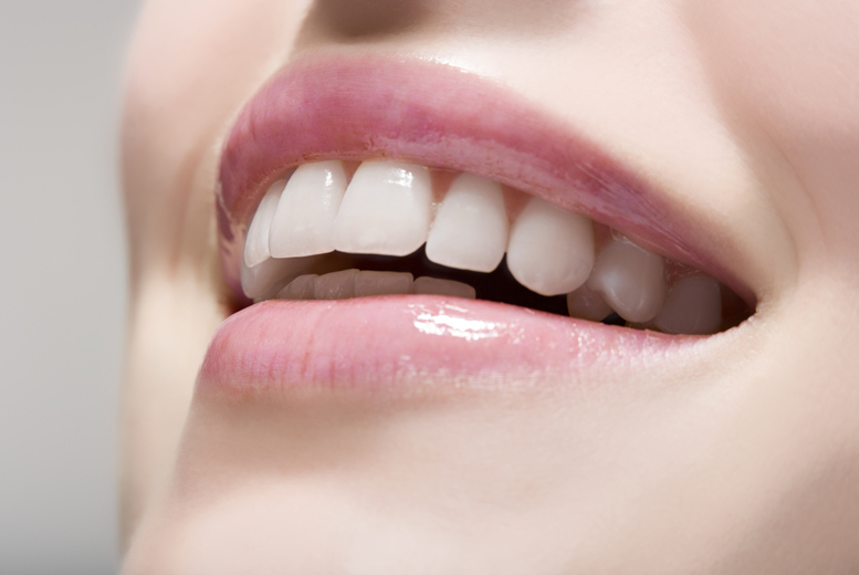 Invisible Retainers for Top & Bottom Teeth - StarSmiles, 8 Locations | Wowcher