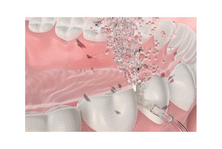 Electric Cordless Water Flosser for Deep Cleaning - 4 Nozzle Pack, Rechargeable, For Gum Care & Whitening | Wowcher