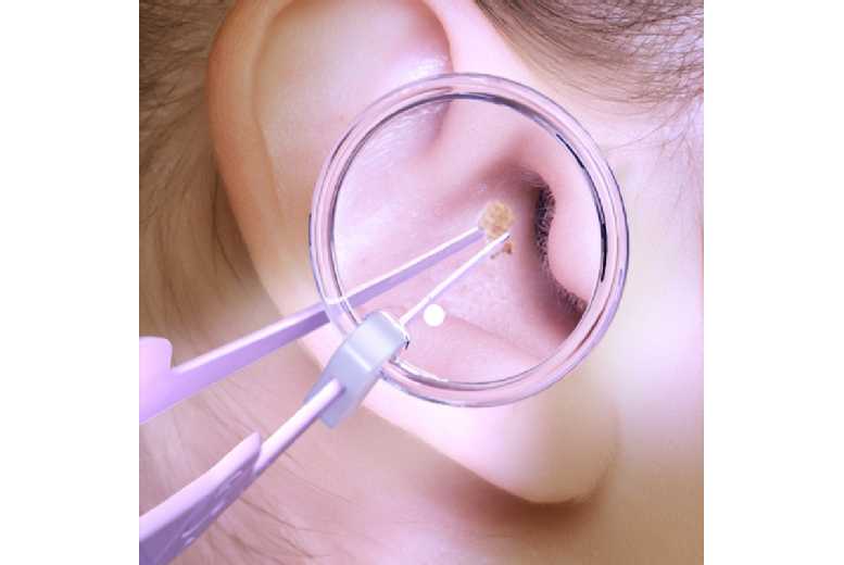 Luminous Ear Cleaning Tool – Soft Silicone Tip, LED Precision, Safe for Sensitive Skin | Wowcher