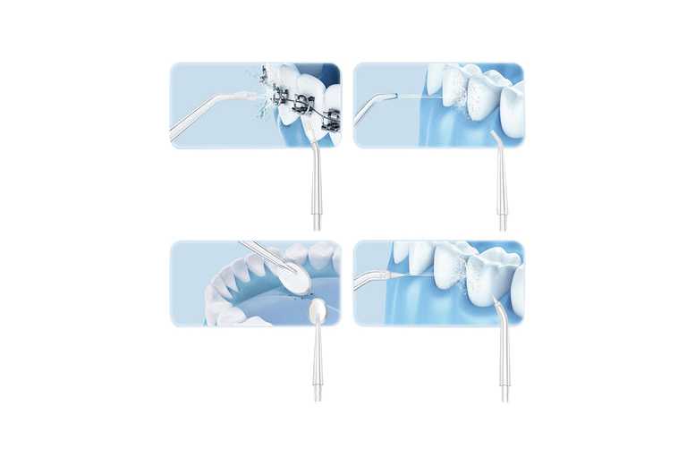 Cordless Water Dental Flosser – Rechargeable Oral Irrigator with 4 Jet Tips for Deep Cleaning & Gum Care | Wowcher