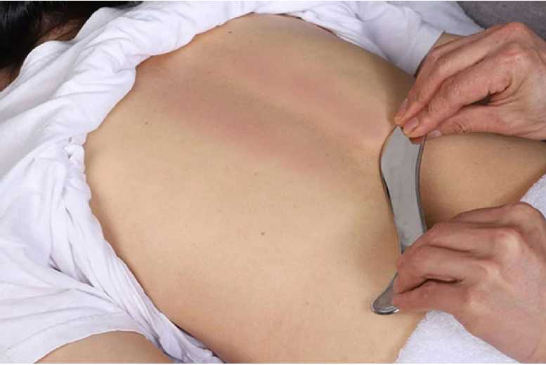 3Pcs Stainless Steel Muscle Scraper Set – Professional Gua Sha Massage Tools for Deep Tissue & Myofascial Release | Wowcher