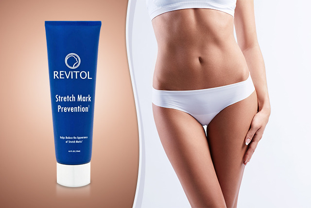 revitol stretch mark